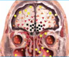NLS-DIAGNOSIS