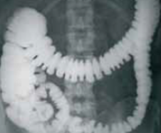 TOMOGRAPHY